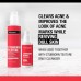 Neutrogena Stubborn Marks PM Treatment with Retinol SA, Face-Exfoliating Treatment to Help Reverse the Look of Post-Acne Marks & Uneven Skin Tone, Oil-Free, Non-Comedogenic, PM Treatment, unscented, 1.0 Fl Oz