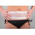 Tummy Tuck Scar Treatment Kit - Effective for 6 Months of Treatment - Results in 1-2 Weeks Buy in Pakistan