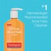 Neutrogena Oil-Free Acne Fighting Facial Cleanser with Salicylic Acid Acne Treatment Medicine, Daily Oil-Free Acne Face Wash for Acne-Prone Skin