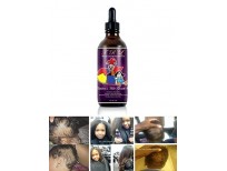 Buy Trl Children's Hair Growth Oil All-Natural Dry Scalp Hair Growth & Eczema Treatment For Sale In Pakistan