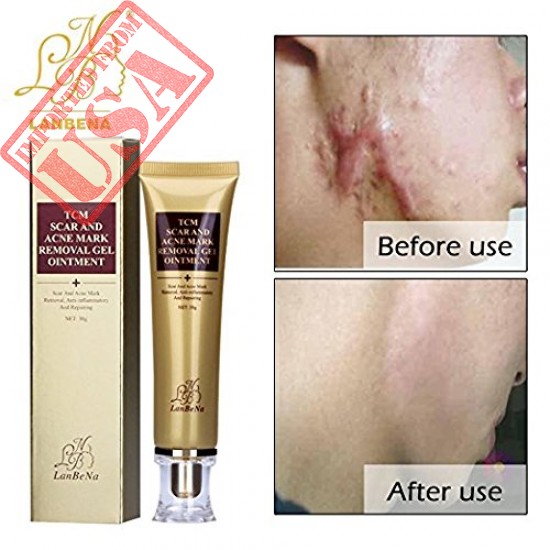 Buy Wisdompark Acne Scar Removal Cream Online in Pakistan