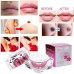 Buy Yosoo Whitening Pinkish Repair Gel Cream for Lip Nipple Online in Pakistan