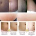 RtopR Mango Stretch Marks and Scar Cream -Stretch Marks and Scar Removal Cream for Pregnancy - Best Body Moisturizer-40g